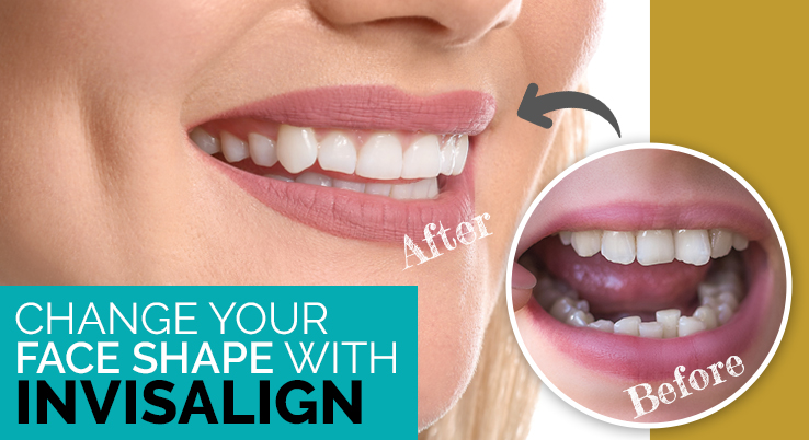 Invisalign or Braces? Does it make a difference? Find out more here.